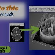 2d Image To 3D Surface Plot Tutorial ImageJ Image Processing