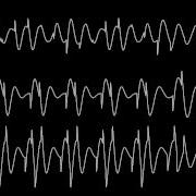 C64 Linus C64 Forever Oscilloscope View