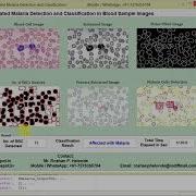 Malaria Detection And Classification Matlab Project With Source Code