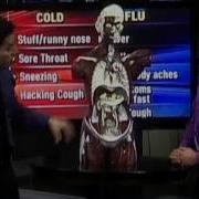Flu Vs Cold What S The Difference
