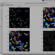 JUMP Cell Painting CellProfiler Analysis Pipeline Walkthrough