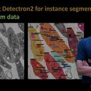 330 Fine Tuning Detectron2 For Instance Segmentation Using Custom Data