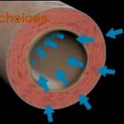 Asthma An Animation YouTube