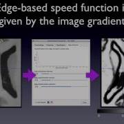 ITK SNAP 3 2 User Training Sessions 6 7 Automatic Segmentation