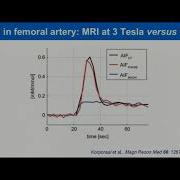 Measurement Of Plasma Input Functions Using MRI