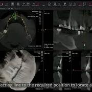 MedDream DICOM Viewer Dental MPR Feature