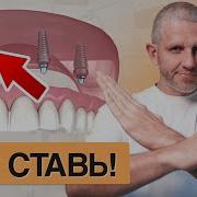 НЕ ДЕЛАЙТЕ ALL ON 4 6 ИЛИ 8 ПОКА НЕ ПОСМОТРИТЕ ЭТО ВИДЕО