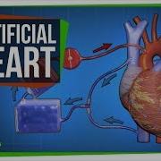 The Key To An Artificial Heart And Open Heart Surgery