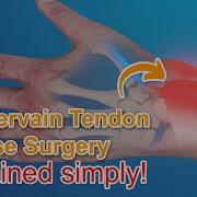 De Quervain Tendon Release Surgery Explained