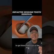 PERFECT Time To Extract IMPACTED Wisdom Tooth In Office To Hands On Dental Training Shorts