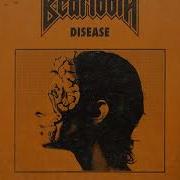 Beartooth Disease