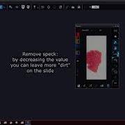3DHISTECH Pannoramic Scanner Software 2 0 5 Tutorial Preview