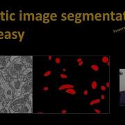 177 Semantic Segmentation Made Easy Using Segmentation Models Library