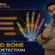 Hand Bone Joint Detection Using Image Processing Python Project Fracture Detection
