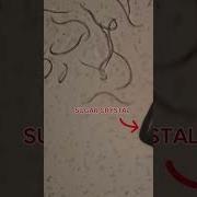 Sugar Vs Parasites Under The Microscope Health Guthealth Naturalremedies Viralshort