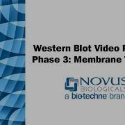 Western Blot Visual Protocol Phase 3 Membrane Transfer