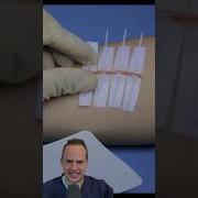 AMAZING WAY TO FIX A CUT WITHOUT STITCHES Shorts