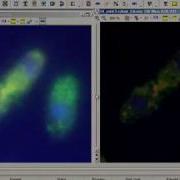 Image Deconvolution With AutoQuant Software