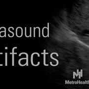 Ultrasound Artifacts