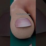 Stop Cutting Your Toenails The Wrong Way Shorts Viralvideo Creativelearning3d
