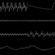 Live A Live Live For Live Oscilloscope