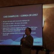Ming Wang MD PhD ASCRS 2016 Presentation On ITrace Technology