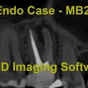 Endodontic Case MB2 CS 3D Imaging Software Version 3 10 12