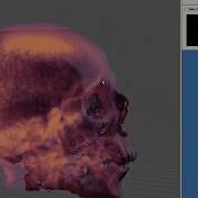 Realtime 3D Visualization Of An MRI Data Set Using HARFANG Python