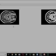 Image Segmentation Using K Means Clustering Algorithm With Proper Working Code