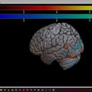 FMRI Analysis Visualization