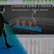 Gait Analysis Force Vector Clinical 3DMA Force Plates II