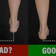 You DON T Need To FIX Your Leg Length Difference