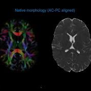 Summer Course 2019 17 Brain Morphometry Using Diffusion MRI