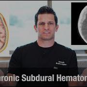 What Is A Chronic Subdural Hematoma