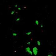 Arabidopsis Line CS84736 Unknown Line MitoTracker RG2B Colocalization