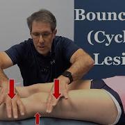 Bounce Test For A Cyclops Lesion In The Knee