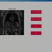 Projects On Image Processing With Source Code Thesis On Image Processing With Source Code