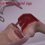 Total Knee Replacement TKR Animation