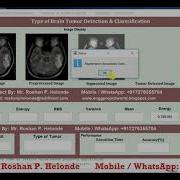 Matlab Code For Brain Tumor Type Detection And Classification Using Image Processing