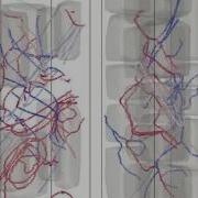 Effect Of Gamma Prime Volume Fraction On Dislocation Microstructure Evolution In Superalloys