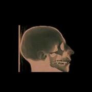 Volume Rendering Visible Human Head
