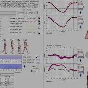GaitLab Laitronic