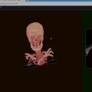 WebGL Volume Rendering