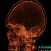 Volumetric Rendering Of Human CT Scan Via Yt