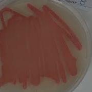 Simulation Of An EPIDEMIC Results Instructions