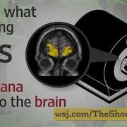 Marijuana Heavy Users Risk Changes To Brain