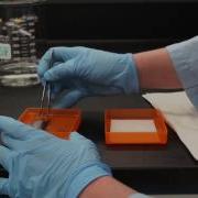 Protein Microarray Interaction Assay