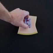 ITClamp Removal