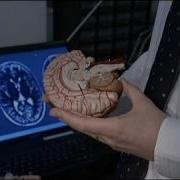 Euronews Science Depression Researchers Pinpoint Brain Anomaly