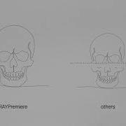 Introducing RAYPreMiere 18x16 CBCT